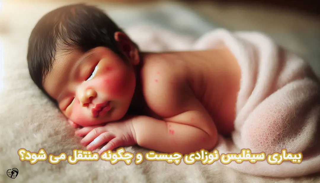 سیفلیس نوزادی سیفلیس نوزادی