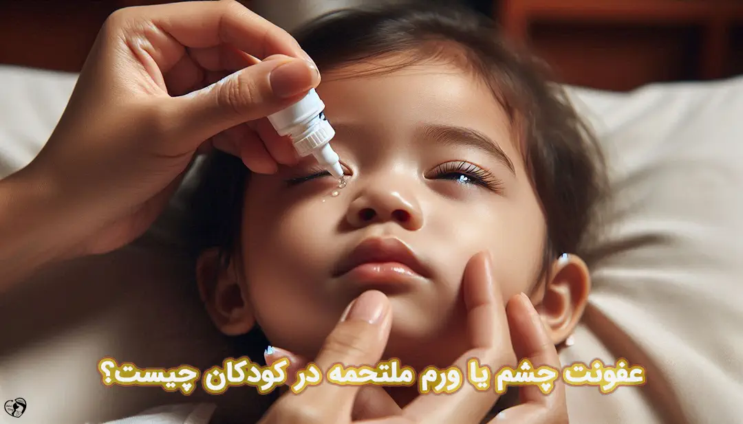 عفونت چشم در کودکان عفونت چشم در کودکان