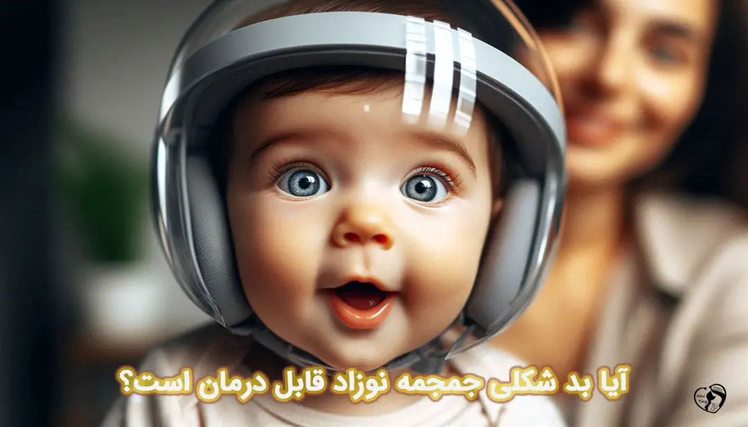 بد شکلی جمجمه نوزاد بد شکلی جمجمه نوزاد