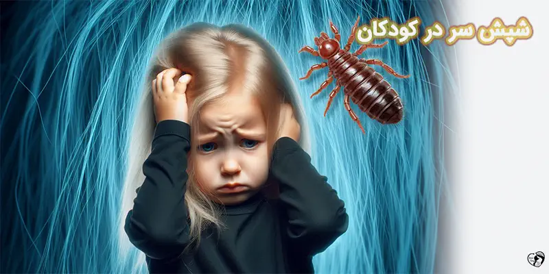 شپش سر در کودکان