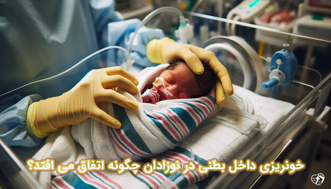 خونریزی داخل بطنی در نوزادان