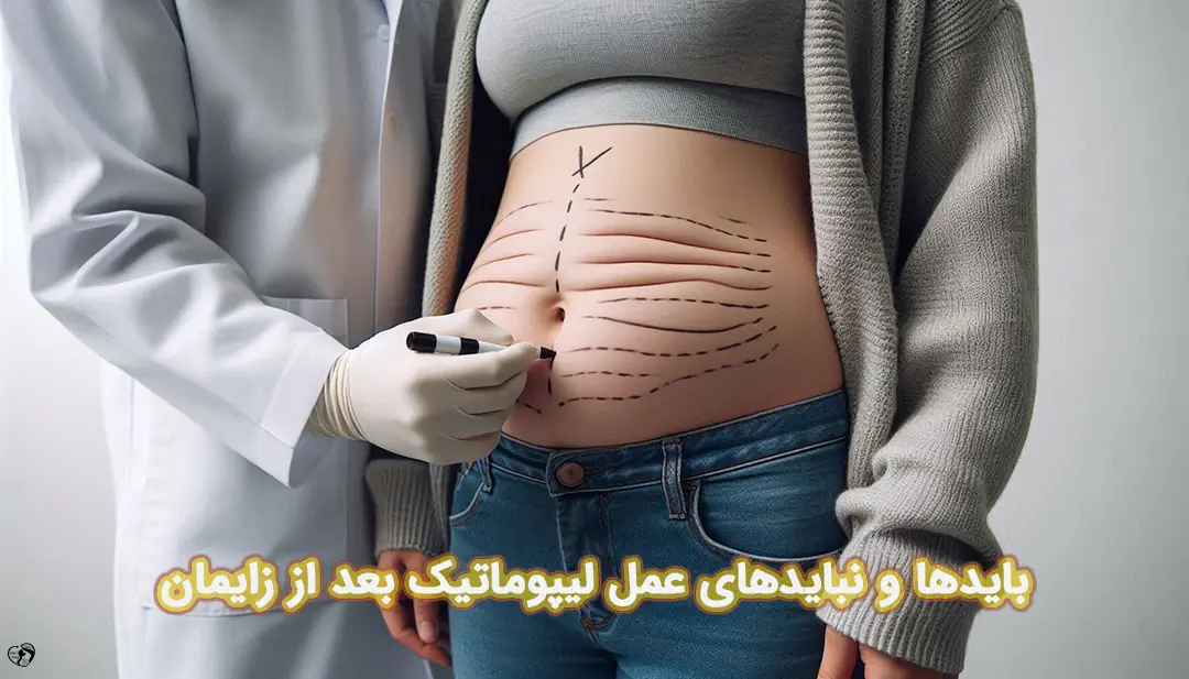 لیپوماتیک بعد از زایمان