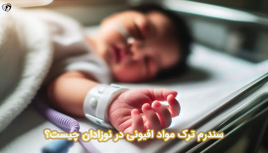 سندرم ترک مواد در نوزادان سندرم ترک مواد در نوزادان