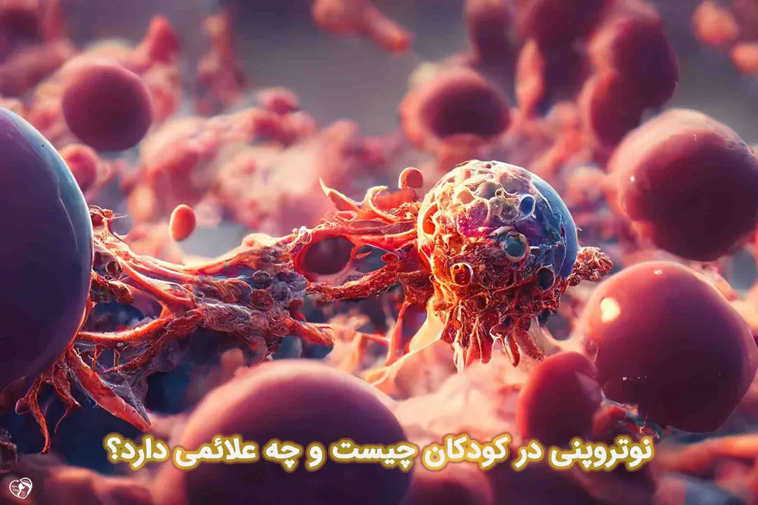 کاهش گلبول سفید در کودکان کاهش گلبول سفید در کودکان