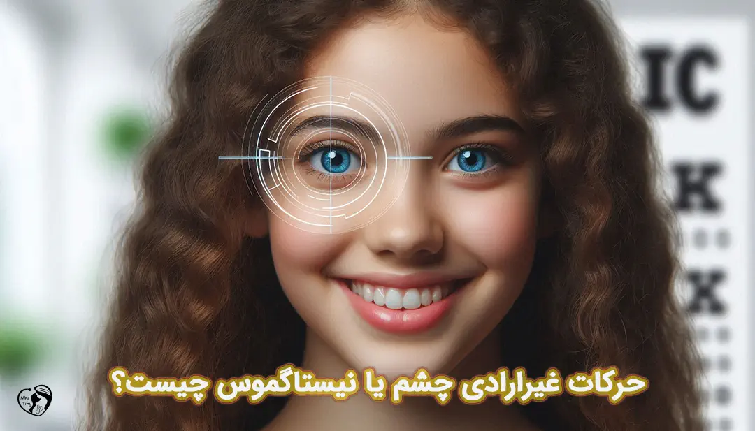نیستاگموس در کودکان نیستاگموس در کودکان