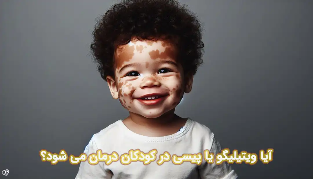 ویتیلیگو در کودکان ویتیلیگو در کودکان