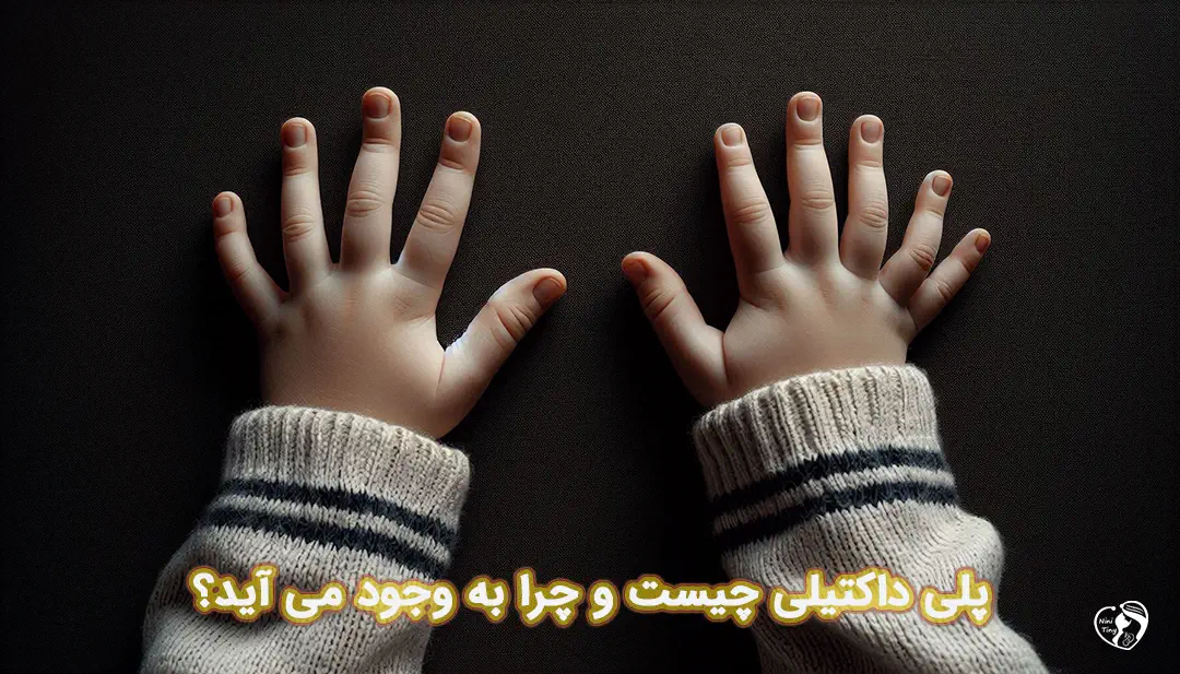 پلی داکتیلی پلی داکتیلی