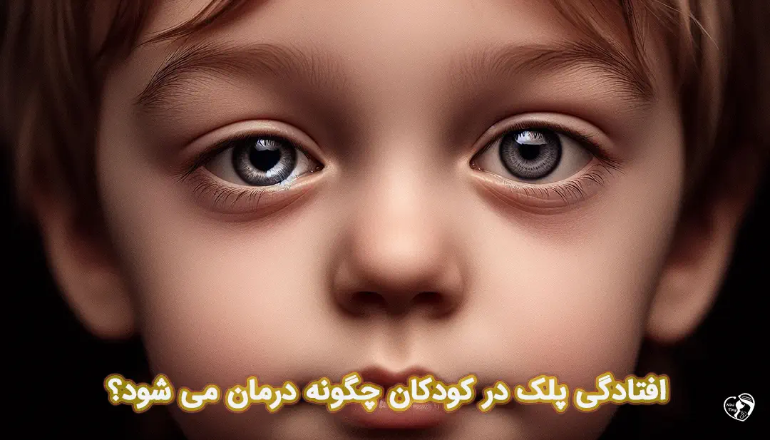 افتادگی پلک در کودکان افتادگی پلک در کودکان