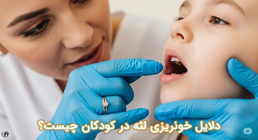 خونریزی لثه در کودکان خونریزی لثه در کودکان