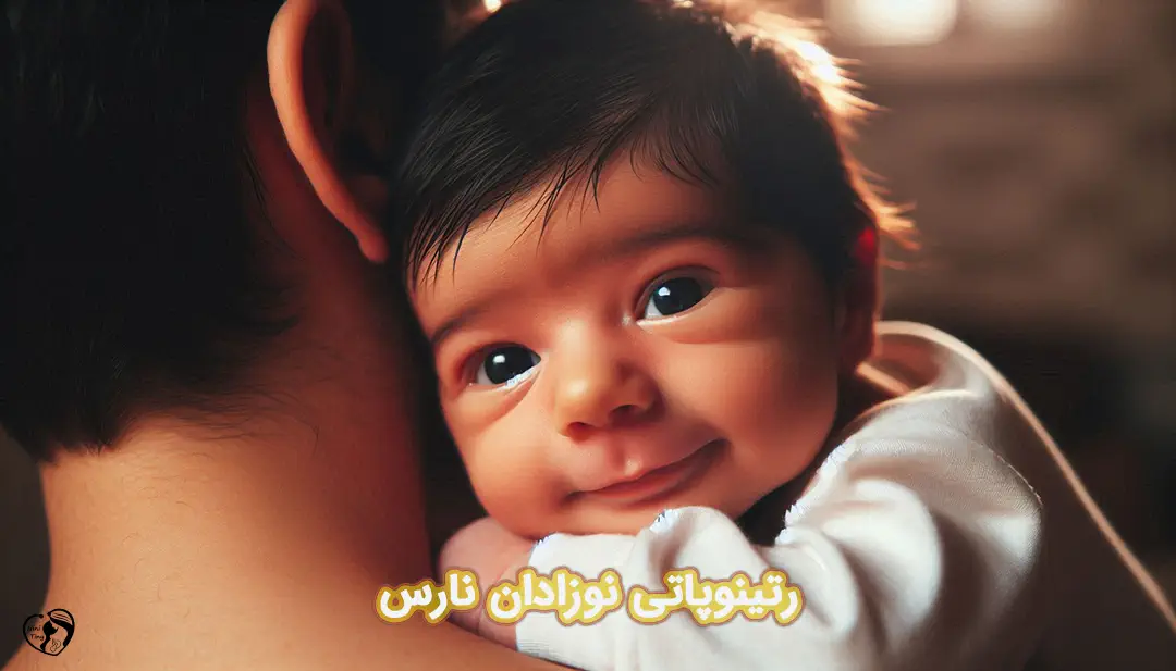 رتینوپاتی نوزادان نارس