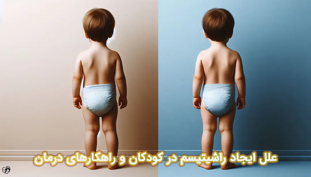 راشیتیسم راشیتیسم