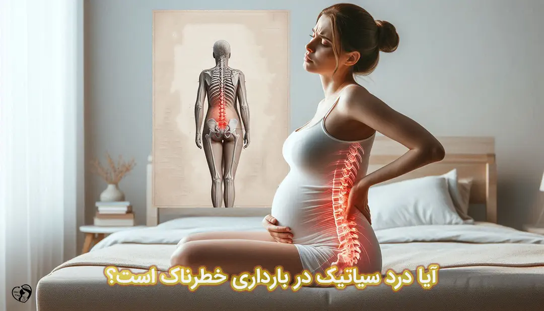درد سیاتیک در بارداری