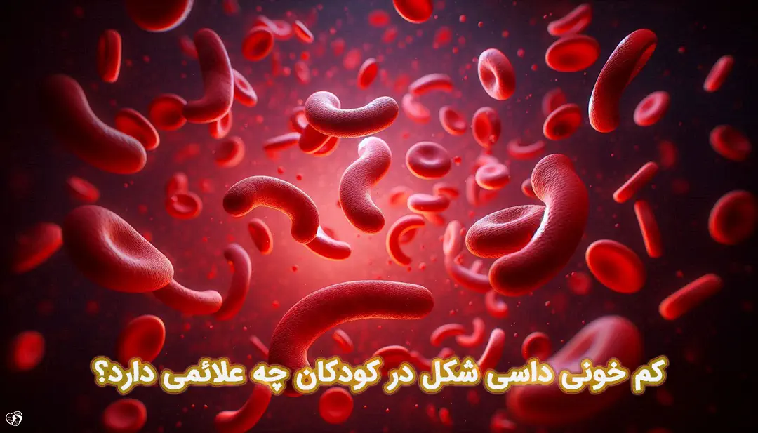 کم خونی داسی شکل در کودکان