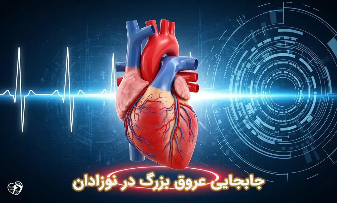 جابجایی عروق بزرگ جابجایی عروق بزرگ