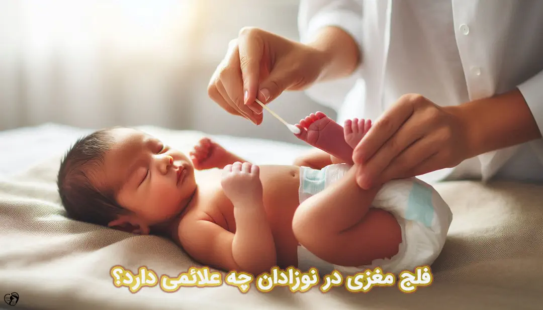 فلج مغزی در نوزادان