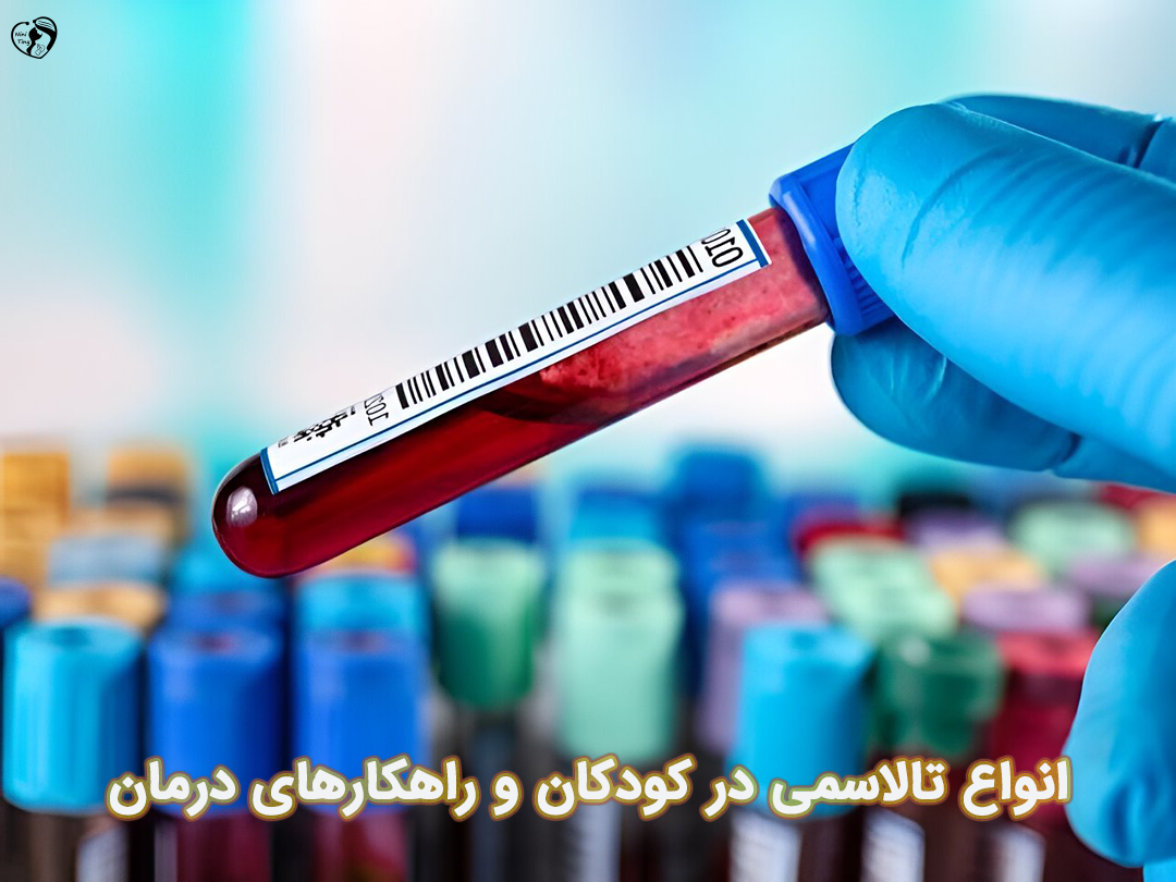 تالاسمی در کودکان