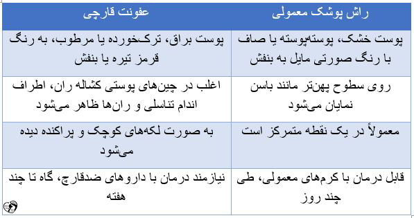 قارچ پوستی در نوزادان