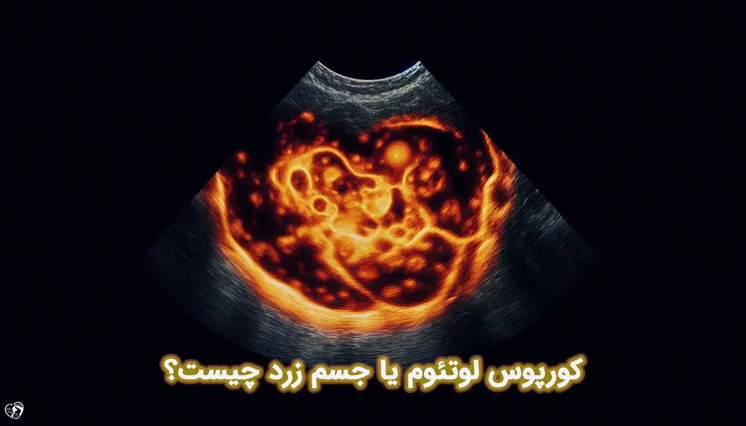 کورپوس لوتئوم کورپوس لوتئوم