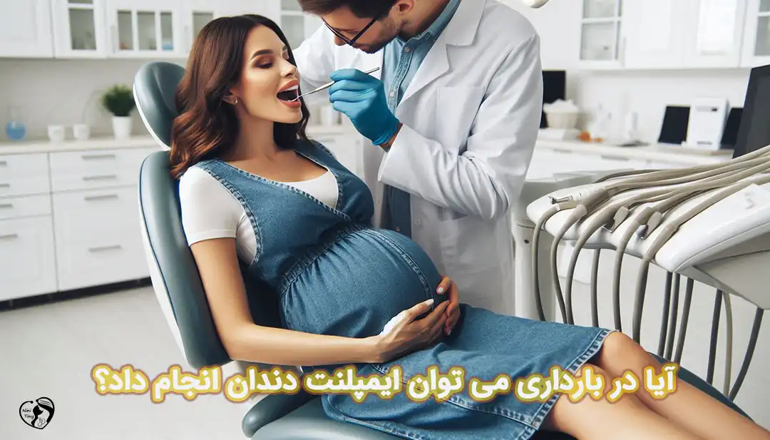 ایمپلنت دندان در بارداری ایمپلنت دندان در بارداری