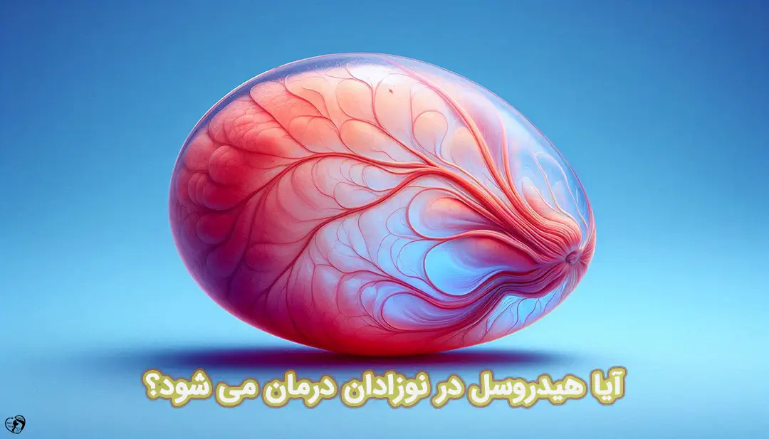 هیدروسل در نوزادان