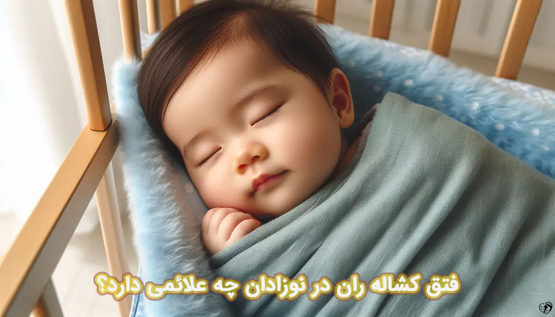 فتق کشاله ران در نوزادان فتق کشاله ران در نوزادان