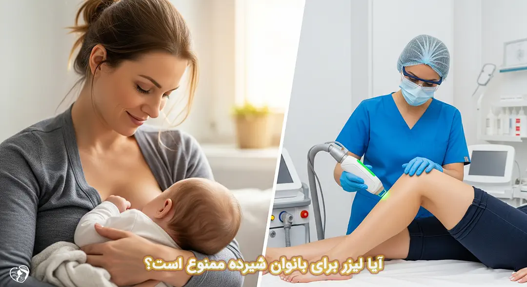 لیزر موهای زائد در شیردهی لیزر در شیردهی