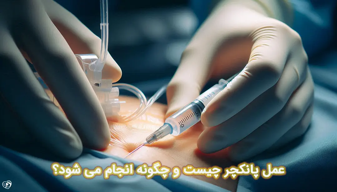 عمل پانکچر