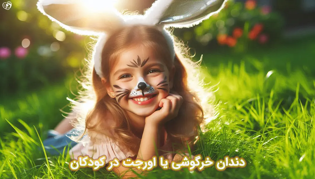 دندان خرگوشی در کودکان