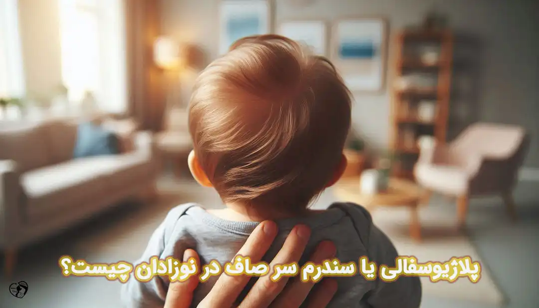سندرم سر صاف در نوزادان