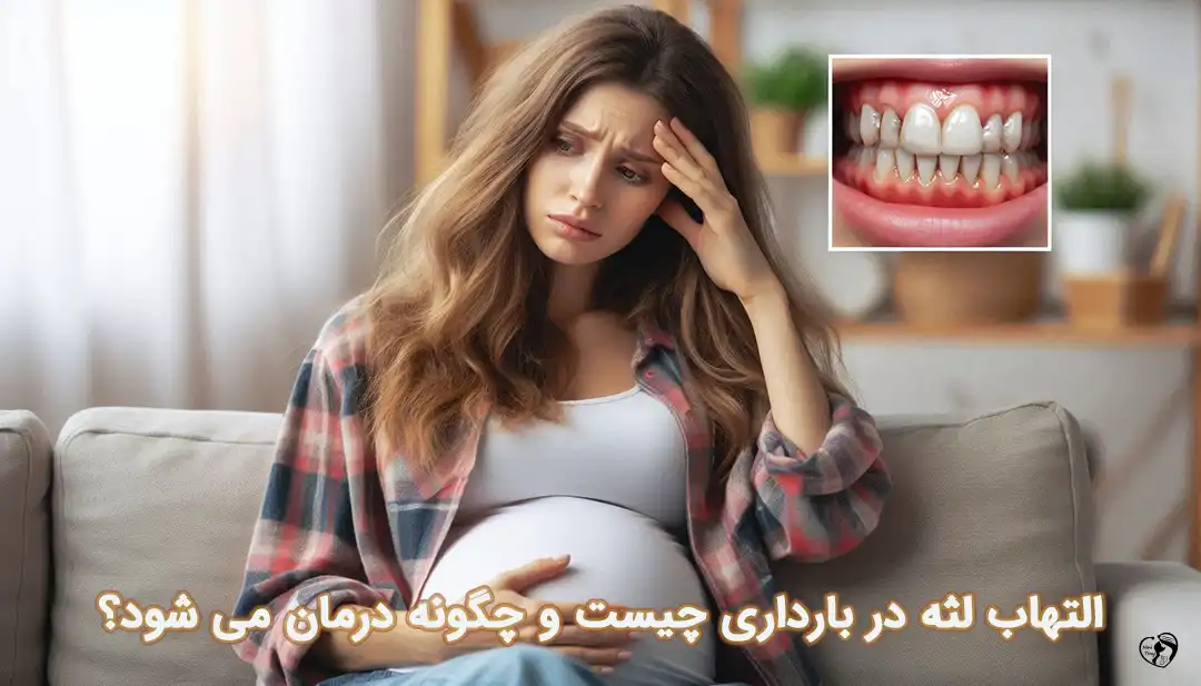 النهاب لثه در بارداری التهاب لثه در بارداری