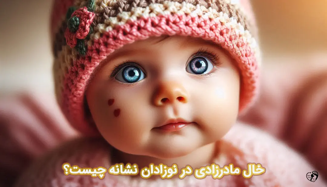 خال مادرزادی در نوزادان