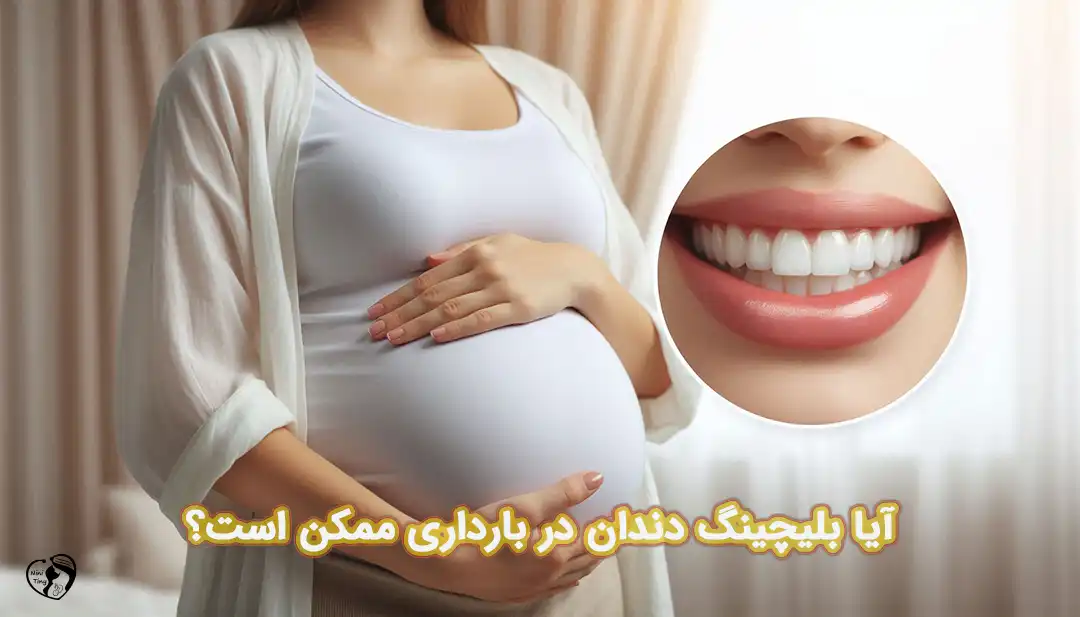 بلیچینگ دندان در بارداری