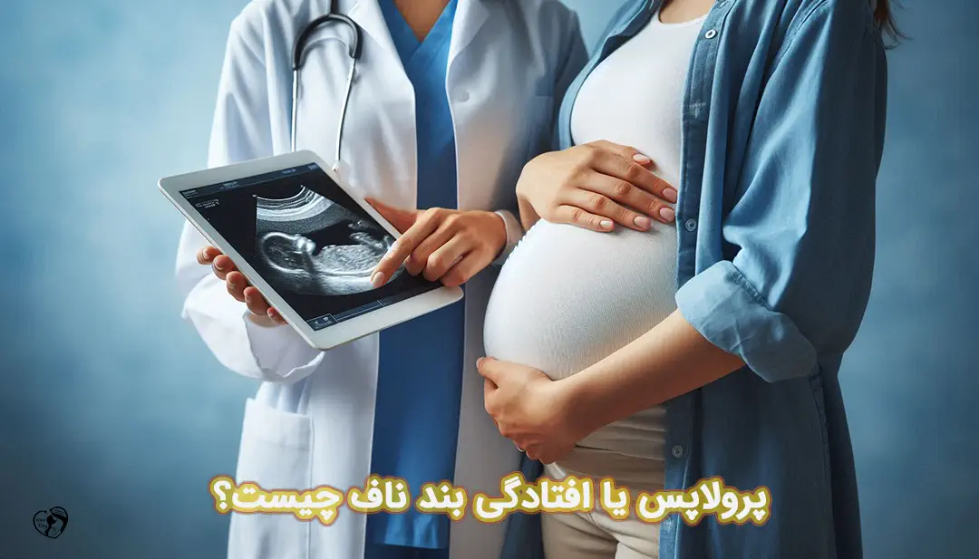 افتادگی بند ناف