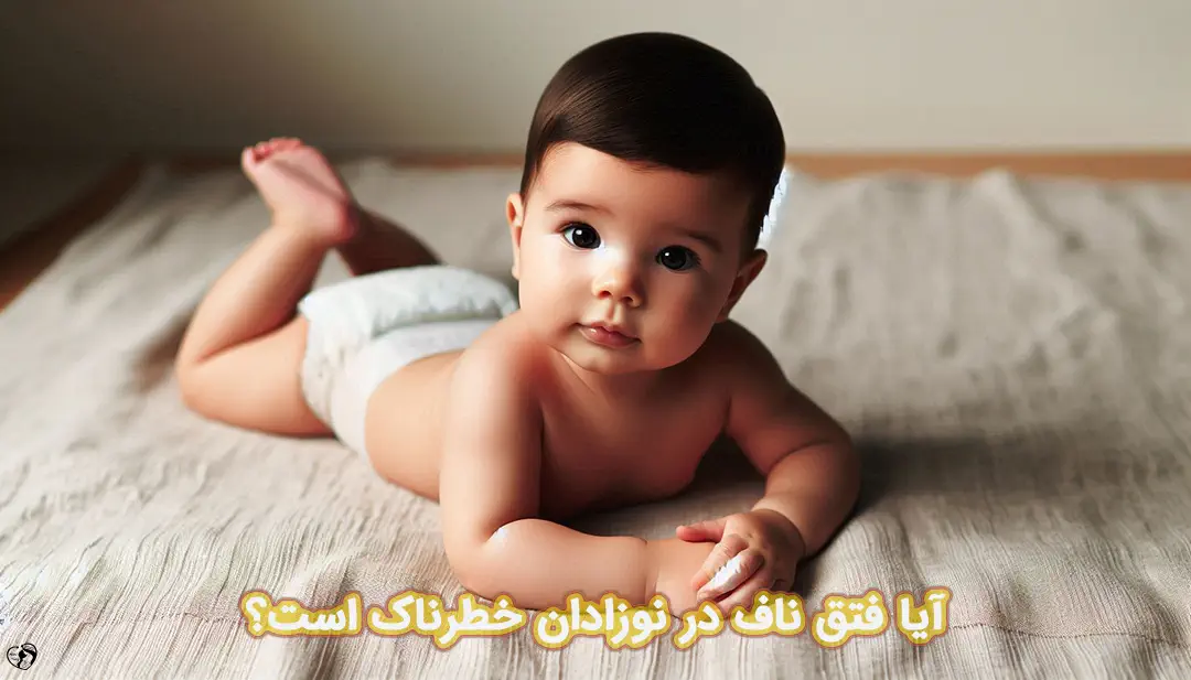 فتق ناف در نوزادان