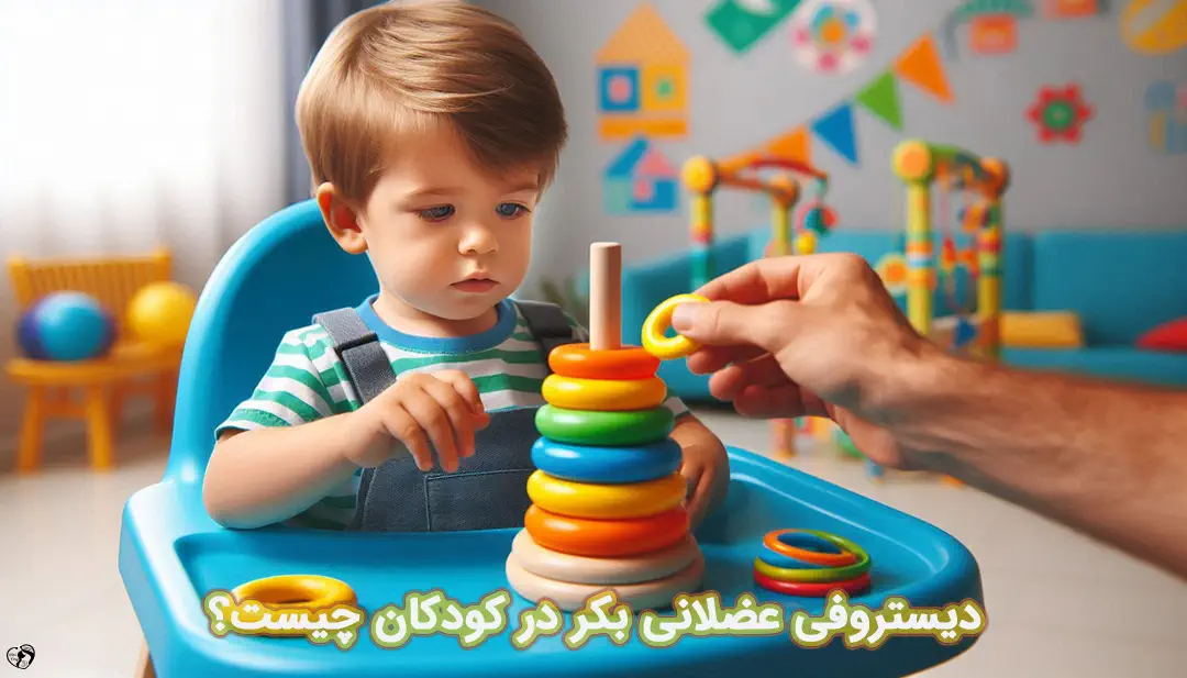دیستروفی عضلانی بکر در کودکان دیستروفی عضلانی بکر در کودکان