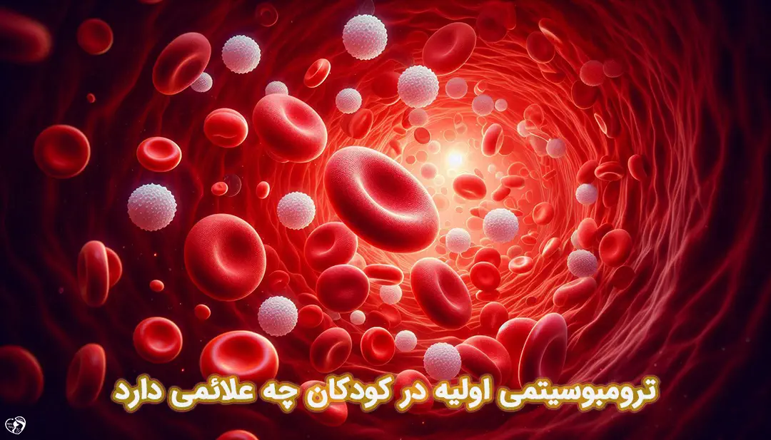 ترومبوسیتمی اولیه در کودکان ترومبوسیتمی اولیه در کودکان