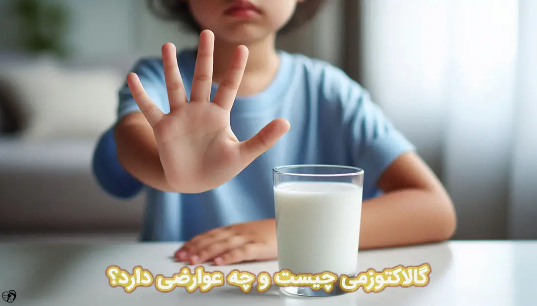 گالاکتوزمی گالاکتوزمی