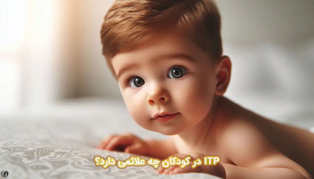 پورپورای ترومبوسیتوپنیک ایدیوپاتیک در کودکان پورپورای ترومبوسیتوپنیک ایدیوپاتیک در کودکان