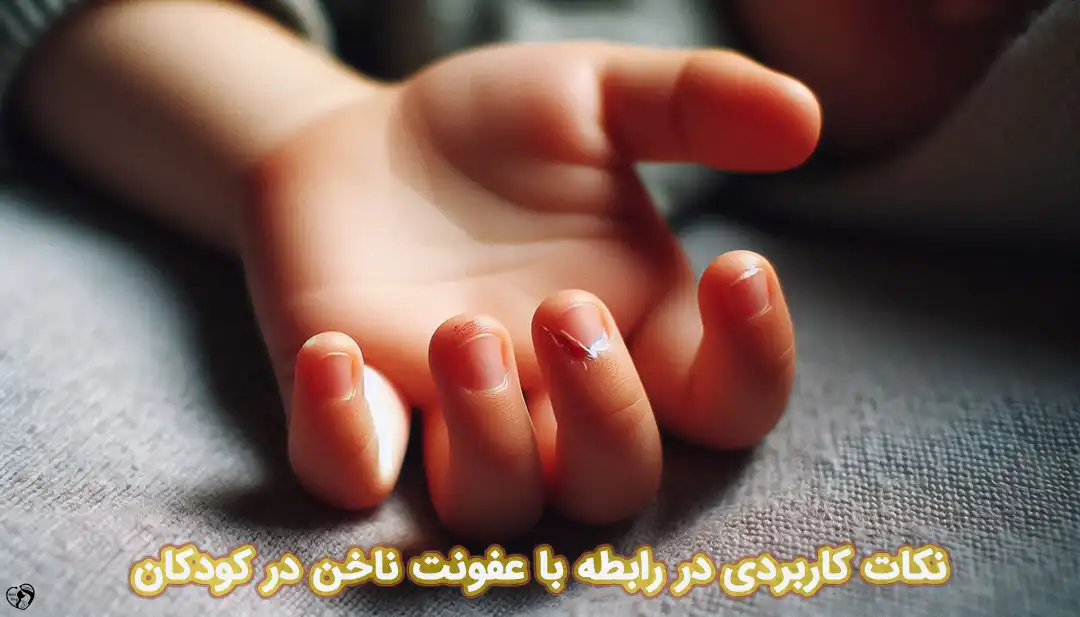 عفونت ناخن در کودکان عفونت ناخن در کودکان
