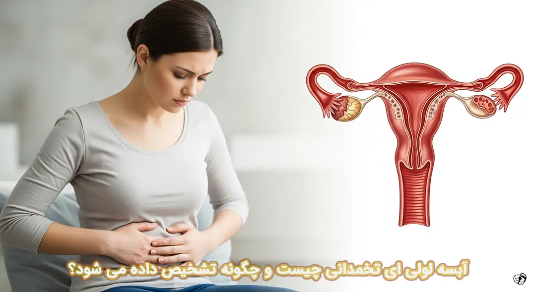 آبسه لوله ای تخمدانی آبسه لوله ای تخمدانی
