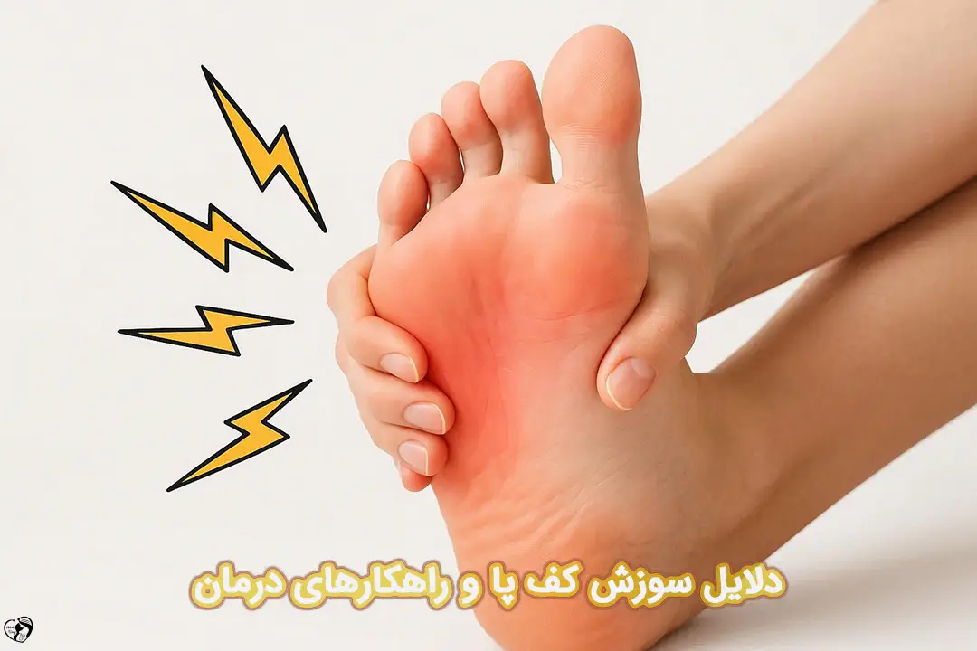 سوزش کف پا سوزش کف پا