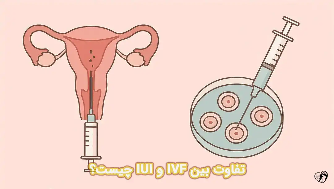 تفاوت IVF و IUI