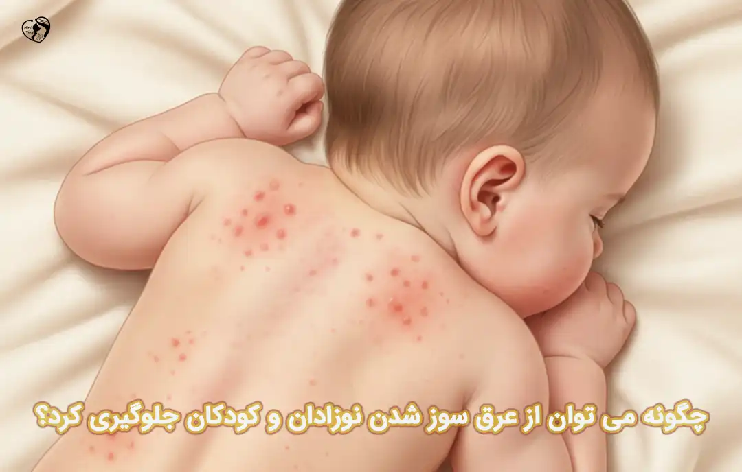 عرق سوز شدن نوزادان