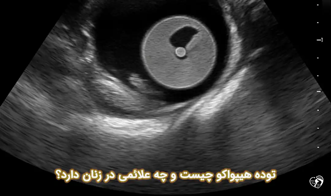 توده هیپواکو توده هیپواکو