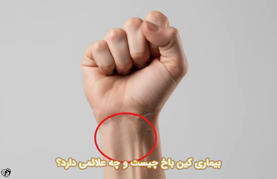 کین باخ کین باخ