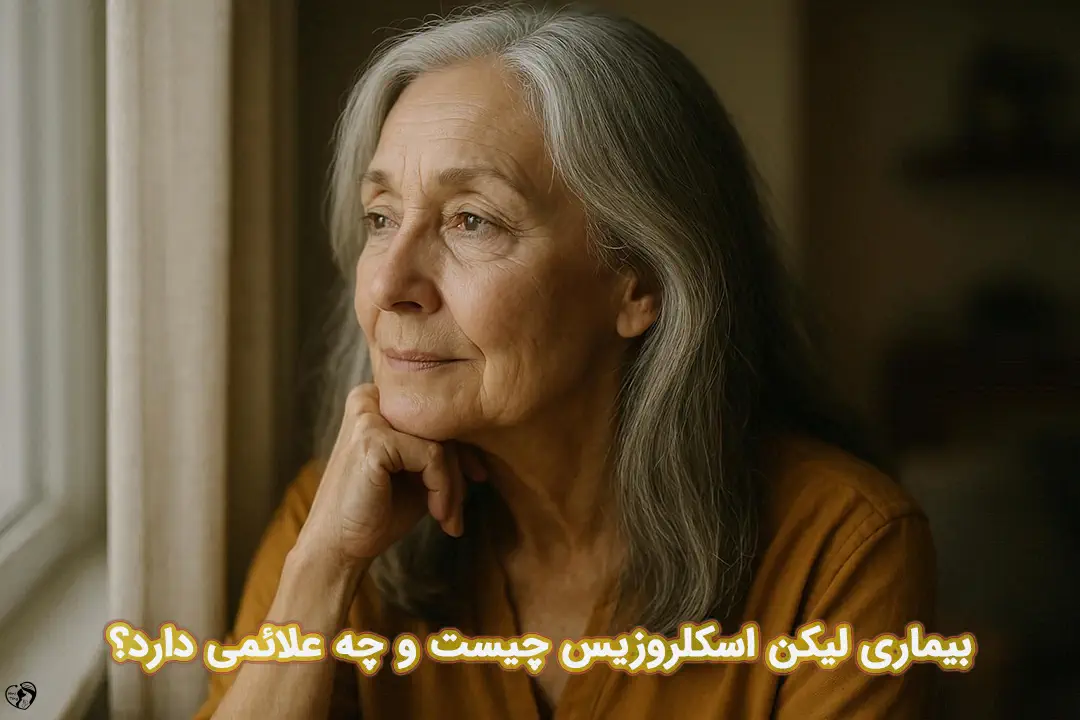 لیکن اسکلروزیس لیکن اسکلروزیس