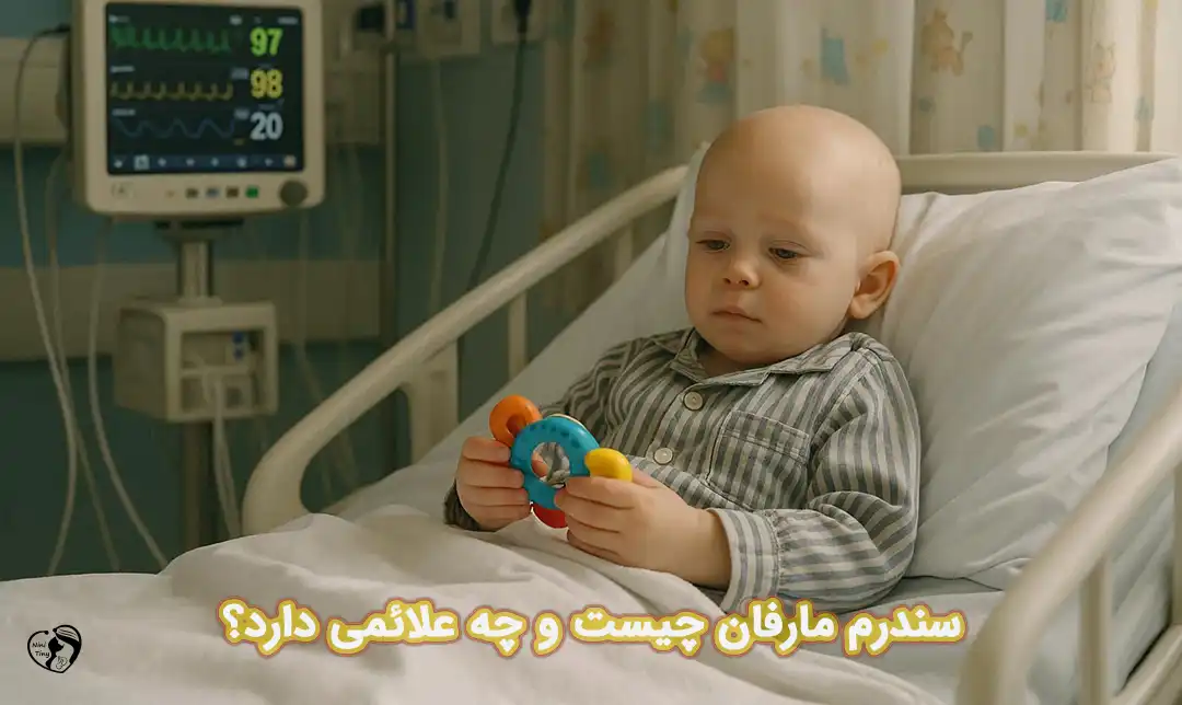 سندرم مارفان
