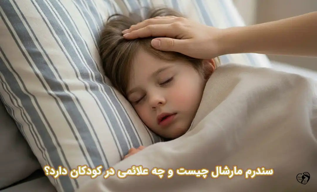 سندرم مارشال سندرم مارشال