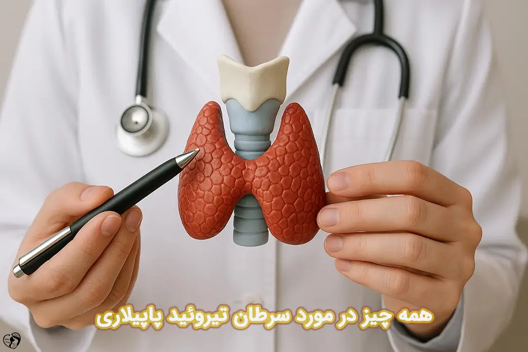 سرطان تیروئید پاپیلاری سرطان تیروئید پاپیلاری