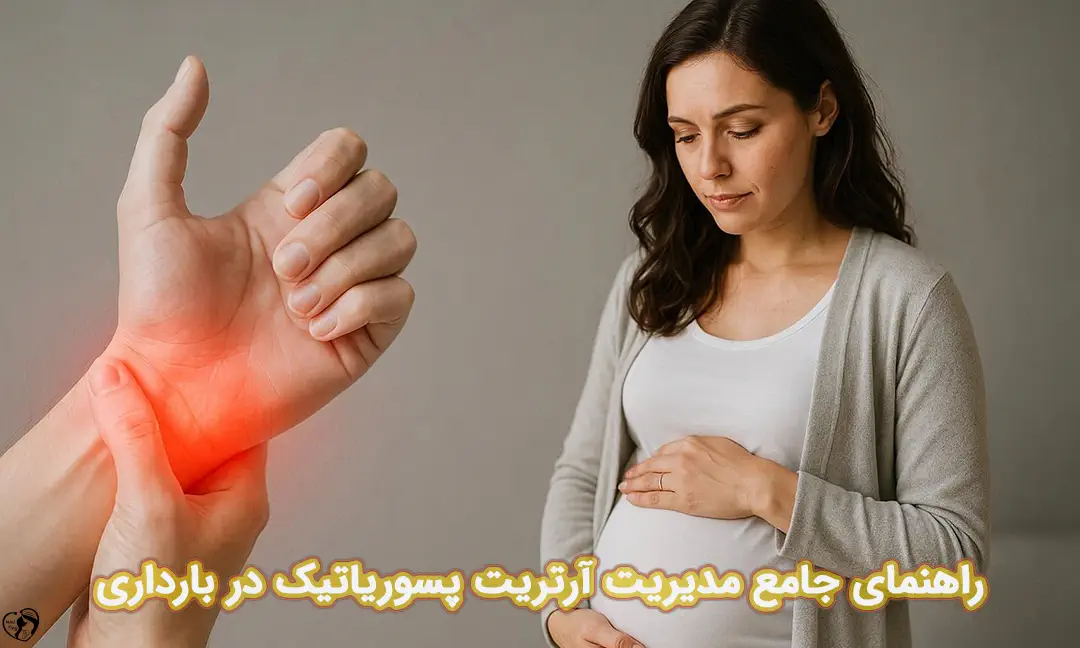آرتریت پسوریاتیک در بارداری